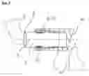 Fig. 03 - Adjustment Unit