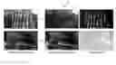 Fig. 01 - Taking photos through visual obstructions