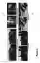 Fig. 09 - Taking photos through visual obstructions