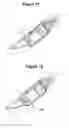 Fig. 09 - Aerosol-generating system comprising moveable cartridge