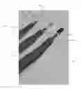 Fig. 01 - Hair extensions