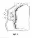 Fig. 04 - Performance footwear, apparel or medical accessory product for hot, cold, and all-weather conditions, the performance footwear, apparel or medical accessory product comprised of a series of material layers