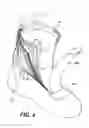 Fig. 05 - Performance footwear, apparel or medical accessory product for hot, cold, and all-weather conditions, the performance footwear, apparel or medical accessory product comprised of a series of material layers
