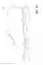 Fig. 13 - Variable-density soles for articles of footwear