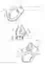 Fig. 01 - Slider cover of slide fastener and slider set