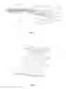 Fig. 02 - Convertible inflatable device