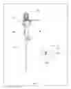 Fig. 02 - Accessory medical device introduction apparatus for endoscopes