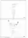 Fig. 05 - Accessory medical device introduction apparatus for endoscopes