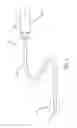 Fig. 02 - Gas sampling catheters, systems and methods