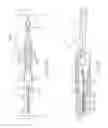 Fig. 24 - Methods and structures for assembling lancet housing assemblies for handheld medical diagnostic devices