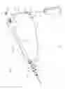 Fig. 08 - Systems and methods for phlebotomy through a peripheral IV catheter