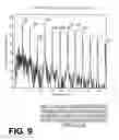 Fig. 07 - Filtering patient signal also for ventilation artifacts
