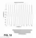 Fig. 10 - Filtering patient signal also for ventilation artifacts