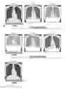 Fig. 01 - Radiation Image Processing System And Radiation Image Processing Apparatus