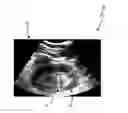 Fig. 01 - Ultrasound imaging apparatus and method for segmenting anatomical objects