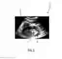 Fig. 06 - Ultrasound imaging apparatus and method for segmenting anatomical objects