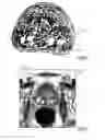 Fig. 07 - Ultrasound imaging apparatus and method for segmenting anatomical objects