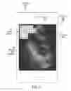 Fig. 06 - Augmented reality interface for assisting a user to operate an ultrasound device