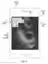 Fig. 06 - Automated image acquisition for assisting a user to operate an ultrasound device