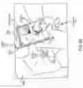 Fig. 08 - Automated image acquisition for assisting a user to operate an ultrasound device