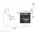 Fig. 01 - Automated image analysis for diagnosing a medical condition