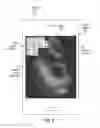 Fig. 06 - Automated image analysis for diagnosing a medical condition
