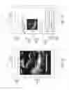 Fig. 12 - Automated image analysis for diagnosing a medical condition