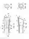 Fig. 05 - Tissue cutting member for a biopsy device