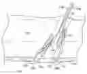 Fig. 01 - Suture-based closure with hemostatic tract plug
