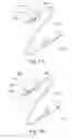 Fig. 02 - REMOVABLE MEDICAL RETRACTOR TIP