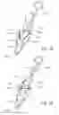Fig. 07 - REMOVABLE MEDICAL RETRACTOR TIP