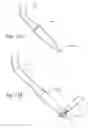 Fig. 22 - REMOVABLE MEDICAL RETRACTOR TIP