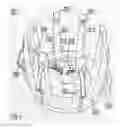 Fig. 08 - Umbilical catheterization device