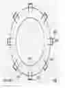 Fig. 16 - Umbilical catheterization device