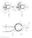Fig. 02 - Device for anchoring a suture