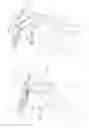 Fig. 07 - Minimally invasive surgical suturing device with improved visualization