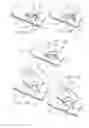 Fig. 35 - Minimally invasive surgical suturing device with improved visualization