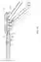 Fig. 80 - Apparatus and method for minimally invasive suturing