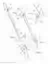 Fig. 02 - SURGICAL CLOSURE APPARATUS AND METHOD