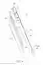 Fig. 03 - SURGICAL CLOSURE APPARATUS AND METHOD