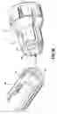 Fig. 23 - Methods and devices for performing a surgical anastomosis