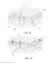 Fig. 09 - Method and systems for occluding vessels during cardiac ablation including optional electroanatomical guidance