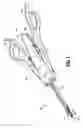 Fig. 02 - Surgical clip applier