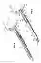 Fig. 06 - Surgical clip applier