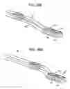 Fig. 28 - Multi-segment lateral cages adapted to flex substantially in the coronal plane