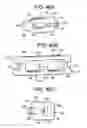 Fig. 33 - Multi-segment lateral cages adapted to flex substantially in the coronal plane