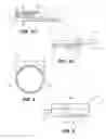 Fig. 04 - METHOD AND APPARATUS FOR ACCELERATED DISINTEGRATION OF BLOOD CLOT