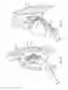 Fig. 06 - Diaphragm entry for posterior surgical access