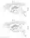 Fig. 07 - Diaphragm entry for posterior surgical access