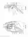 Fig. 09 - Diaphragm entry for posterior surgical access
